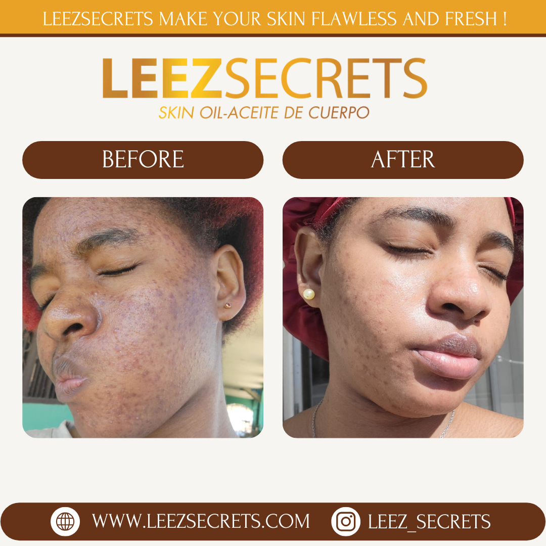 Organic Oil by Leezsecrets