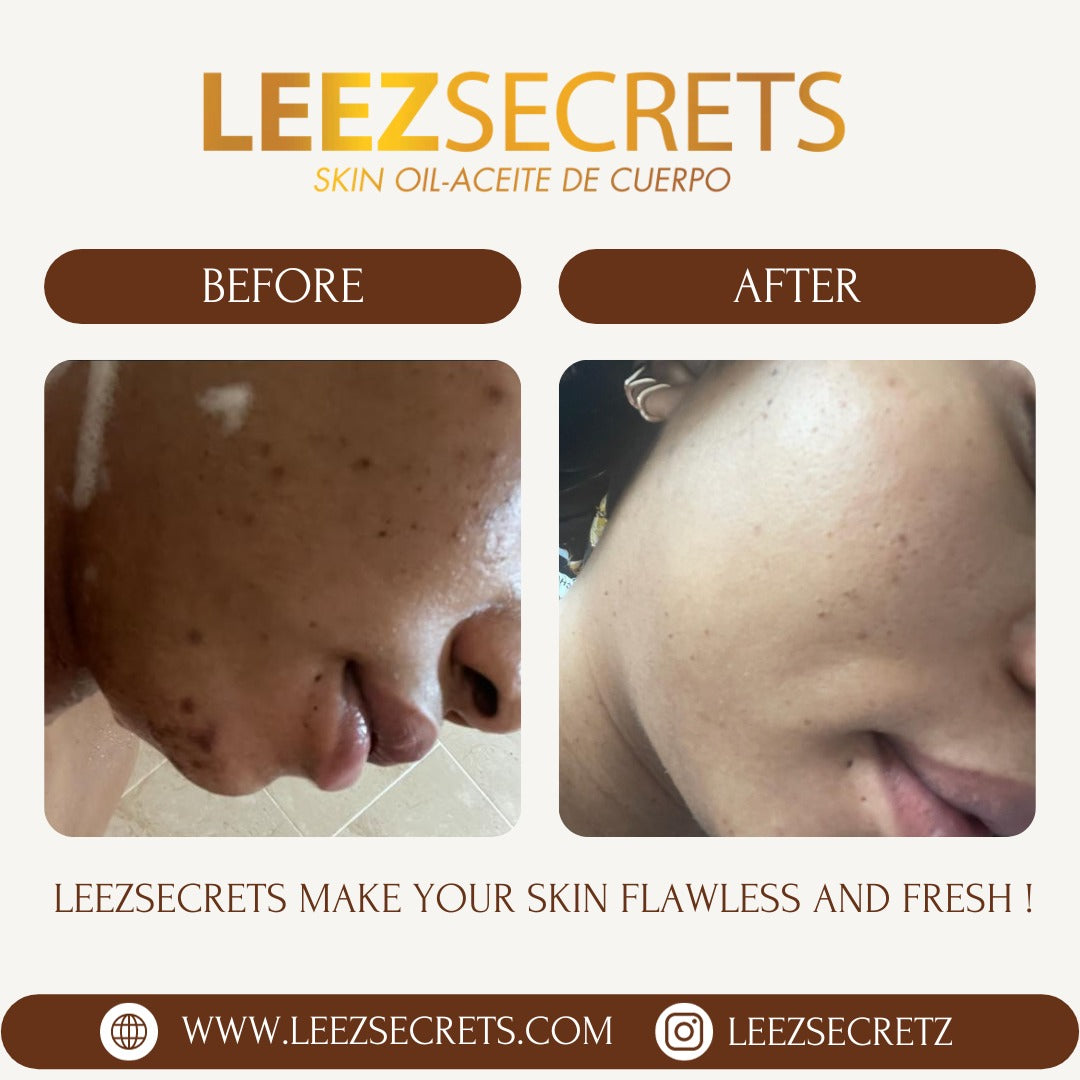 Organic Oil by Leezsecrets