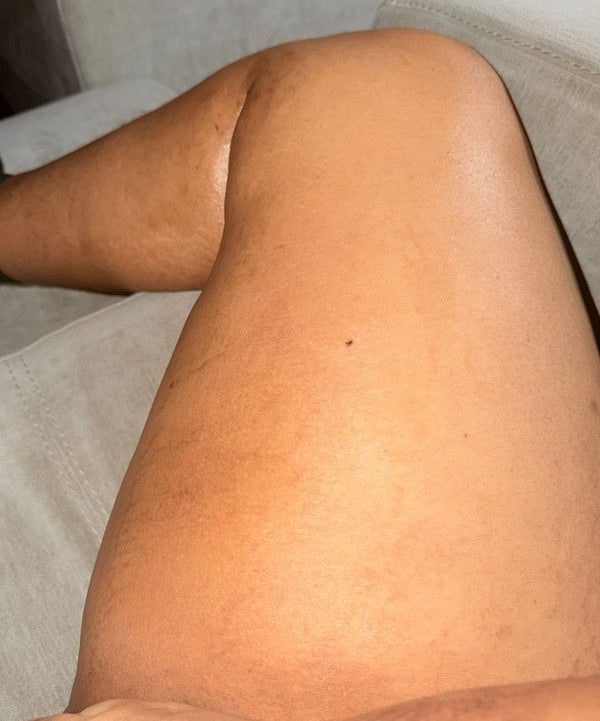 After transformation