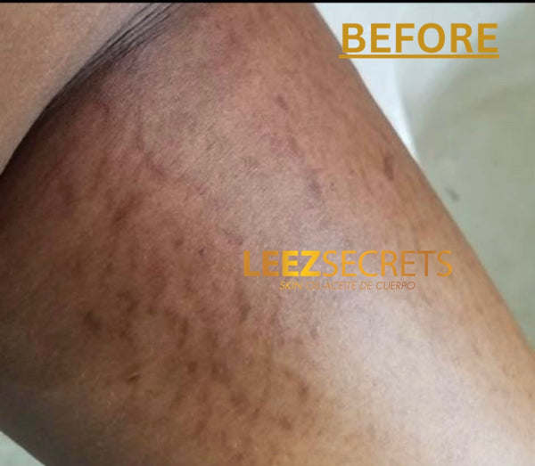 Before transformation