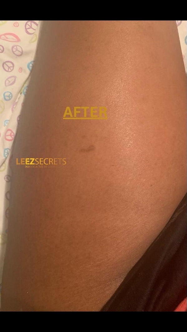 After transformation