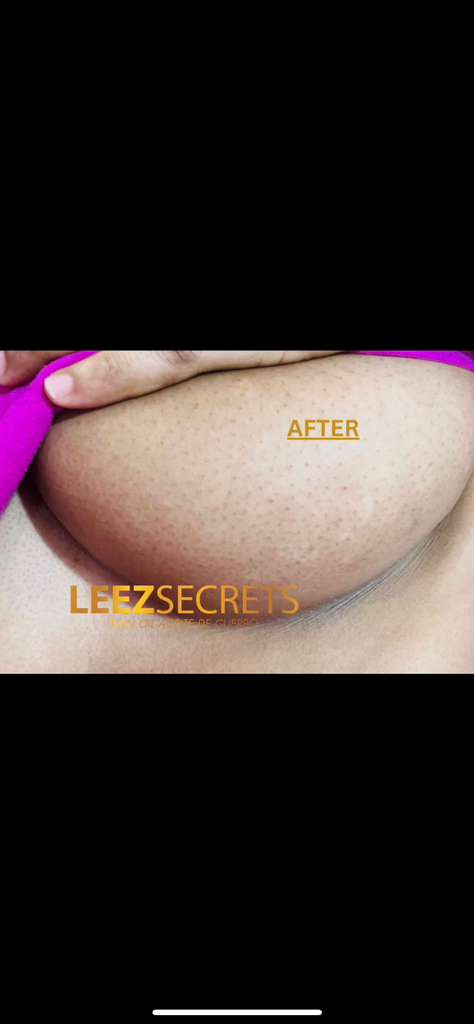 After transformation
