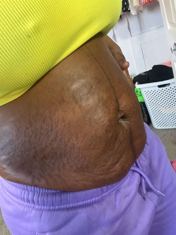 Before transformation