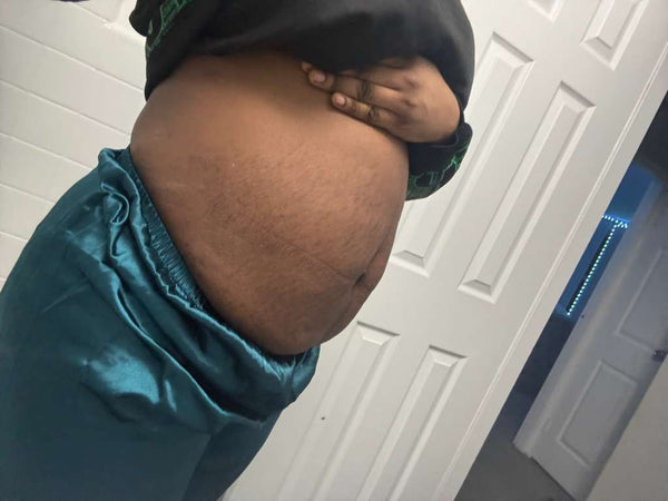 After transformation